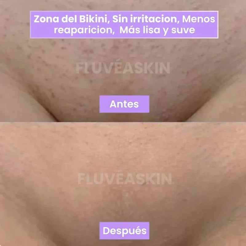 LunéaSkin™ - Vello fino y menos visible con Raiz de Cyperus Rotundus